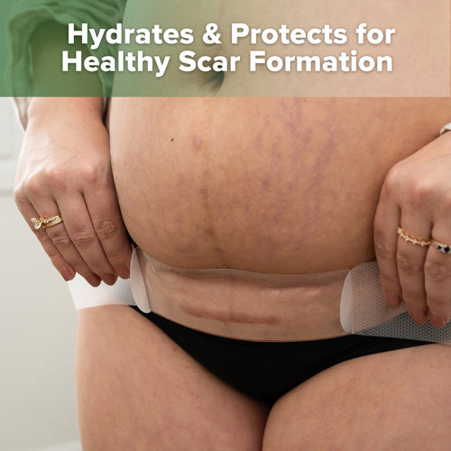 haakaa Mum C-Section Scar Silicone Patches - 6pcs (0.5mm*3 + 1mm*3)