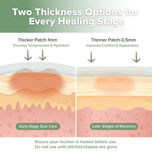 haakaa Mum C-Section Scar Silicone Patches - 6pcs (0.5mm*3 + 1mm*3)